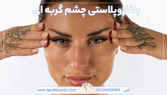بلفاروپلاستی چشم گربه ای