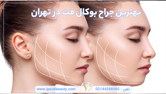 بهترین جراح بوکال فت در تهران
