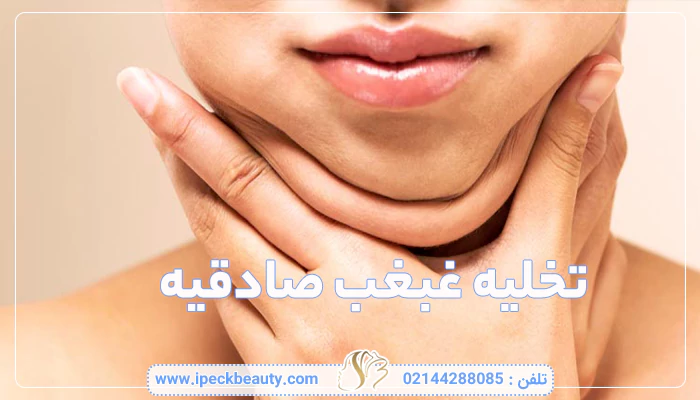 تخلیه غبغب در صادقیه