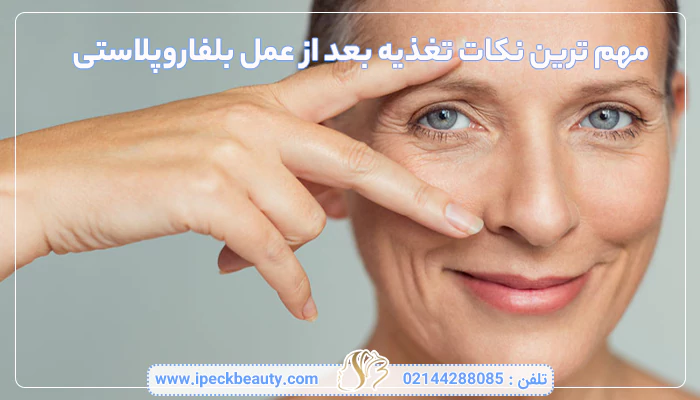 مهم ترین نکات تغذیه بعد از عمل بلفاروپلاستی