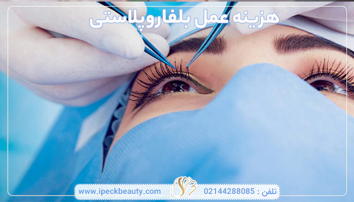 هزینه بلفاروپلاستی