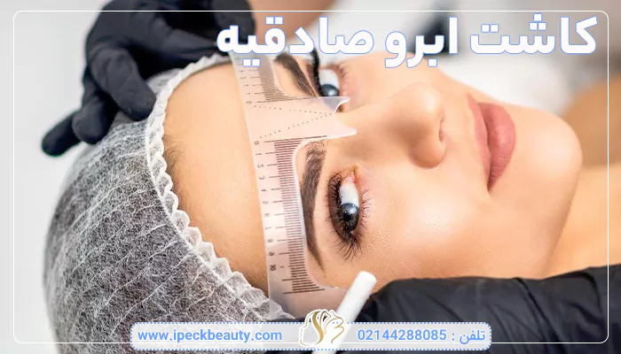کاشت ابرو صادقیه