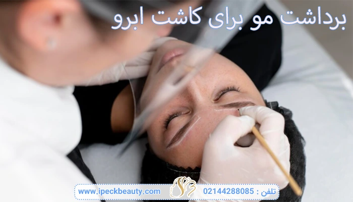 برداشت مو برای کاشت ابرو