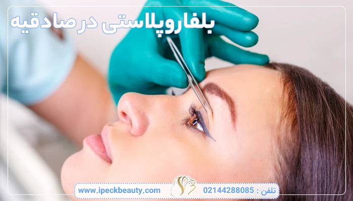 بلفاروپلاستی در صادقیه