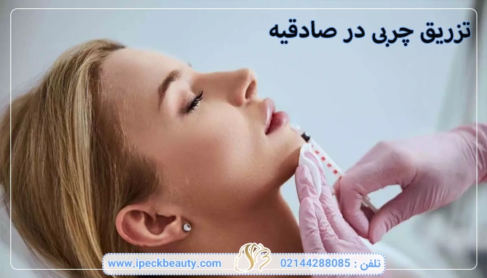 تزریق چربی در صادقیه