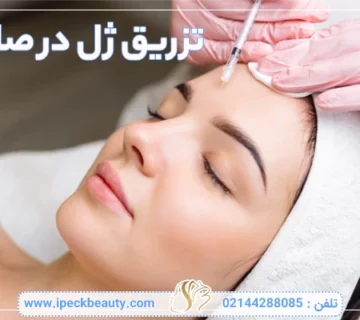 تزریق ژل در صادقیه