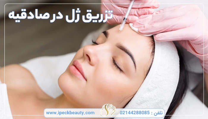 تزریق ژل در صادقیه