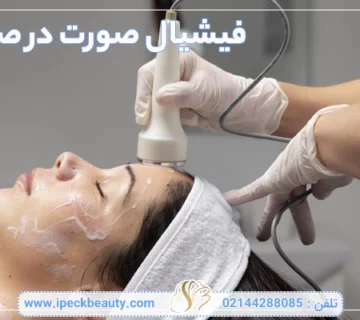 فیشیال صورت در صادقیه-