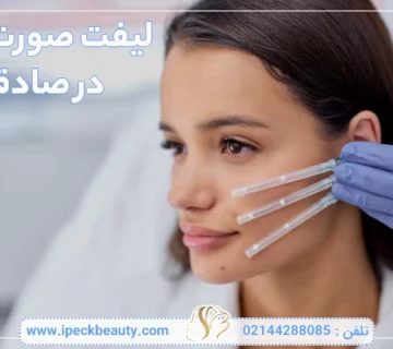 لیفت صورت با نخ در صادقیه