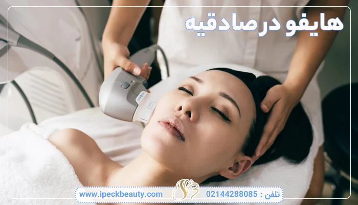 هایفو در صادقیه